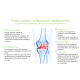Optimale Heilung: Osteoarthritis und Osteoporose - 1 Monat